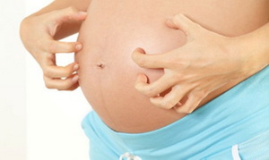 Почему чешется живот во время беременности