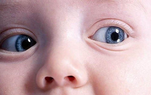 Чем лечить помутнение роговицы глаза у детей